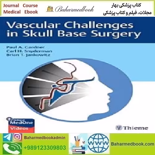 Vascular Challenges in Skull Base Surgery 2022 TRU