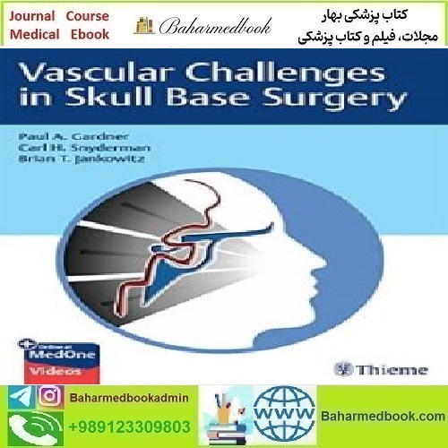 Vascular Challenges in Skull Base Surgery 2022 TRU