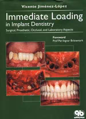 [PDF] دانلود کتاب Immediate Loading In Implant Dentistry - Surgical, Prosthetic, Occlusal, And Laboratory Aspects, 2005