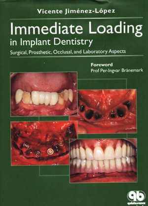 [PDF] دانلود کتاب Immediate Loading In Implant Dentistry - Surgical, Prosthetic, Occlusal, And Laboratory Aspects, 2005