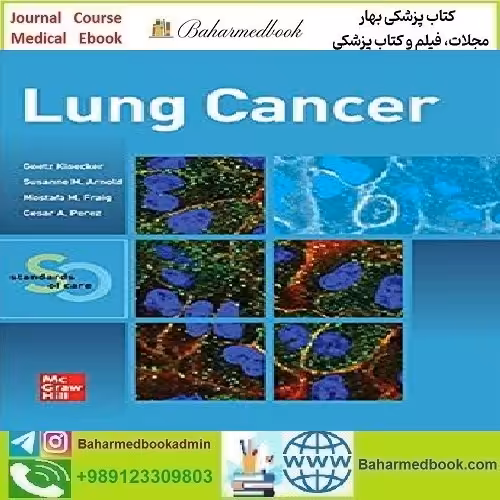 Lung Cancer Standards of Care 2021 CONVERTED PDF price 1€ - کتاب پزشکی بهار