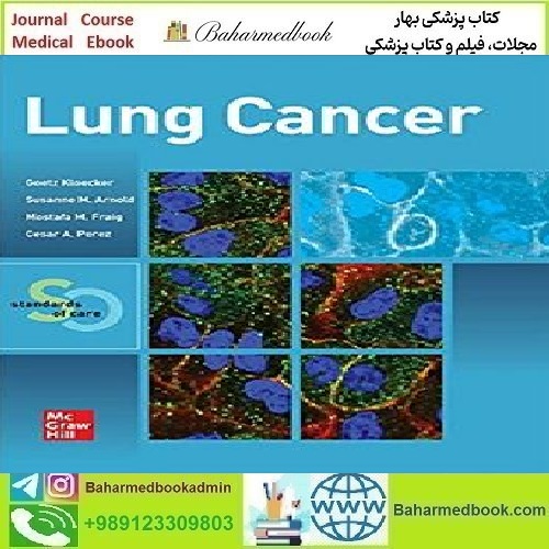 Lung Cancer Standards of Care 2021 CONVERTED PDF price 1€ - کتاب پزشکی بهار