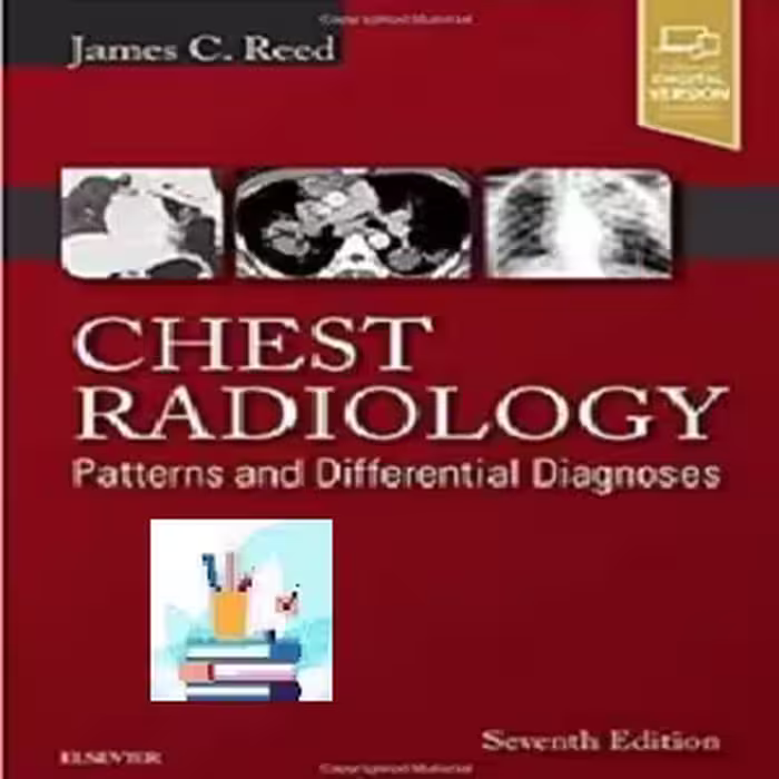 Chest Radiology TRUE PDF price 1€