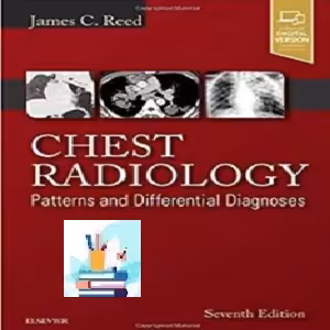Chest Radiology TRUE PDF price 1€