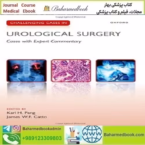 Challenging Cases in Urological SurgeryTRUE PDF price 1€ - کتاب پزشکی بهار