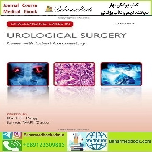 Challenging Cases in Urological SurgeryTRUE PDF price 1€ - کتاب پزشکی بهار