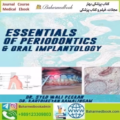 Essentials of Periodontics and Oral Implantology 2021