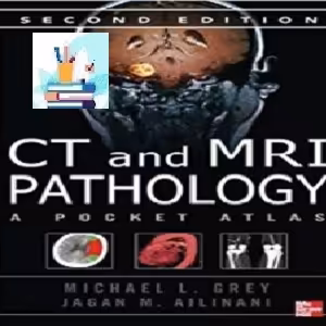 CT &amp; MRI Pathology TRUE PDF price 1€