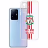 کاور طرح Liverpool مناسب برای گوشی موبایل شیائومی MI11T / MIT pro