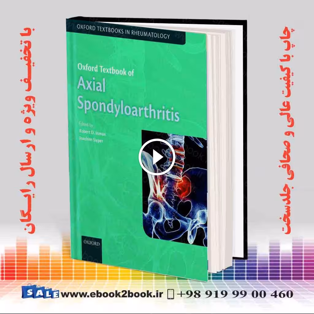 Oxford Textbook of Axial Spondyloarthritis