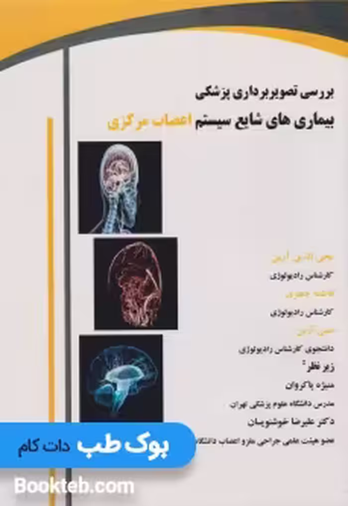 بررسی تصویربرداری پزشکی بیماری های شایع سیستم اعصاب مرکزی