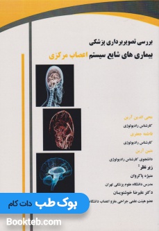 بررسی تصویربرداری پزشکی بیماری های شایع سیستم اعصاب مرکزی