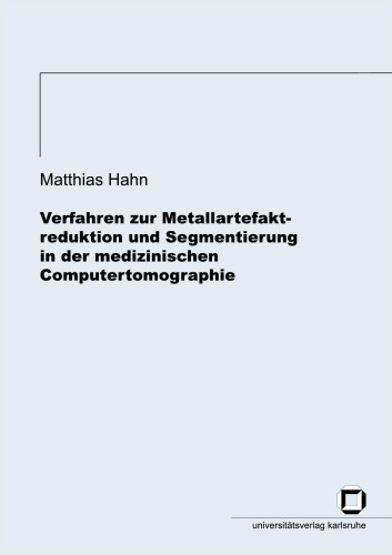 خرید و دانلود نسخه کامل کتاب Verfahren zur Metallartefaktreduktion und Segmentierung in der medizinischen Computertomographie German