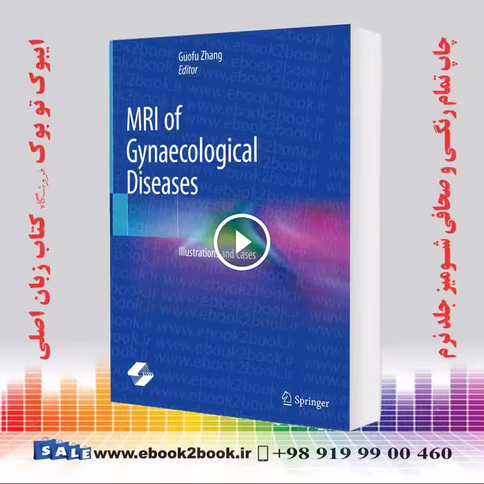 MRI of Gynaecological Diseases: Illustrations and Cases
