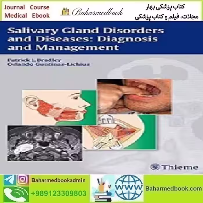 Salivary Gland Disorders and Diseases Diagnosis and Managem
