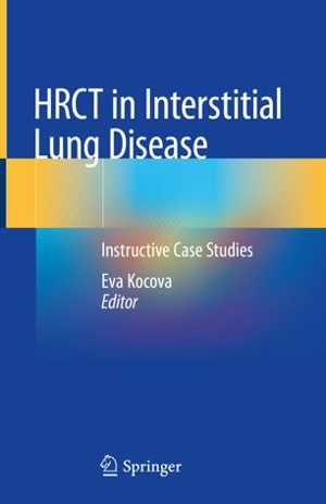 [PDF] دانلود کتاب Hrct In Interstitial Lung Disease - Instructive Case Studies, 2019