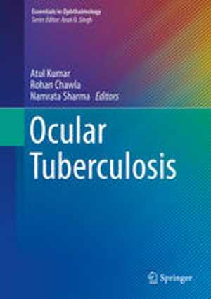 [PDF] دانلود کتاب Ocular Tuberculosis, 2017