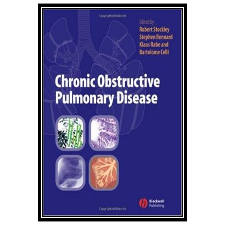 کتاب Chronic Obstructive Pulmonary Disease اثر جمعی از نویسندگان انتشارات مؤلفین طلایی