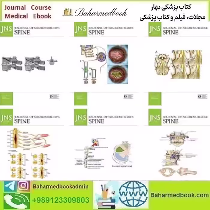 Journal of Neurosurgery Spine 2025 Full Archives TRUE PDF
