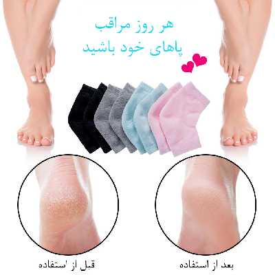 پاشنه پوش مدل TY 524 بسته 2 عددی