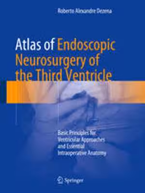 [PDF] دانلود کتاب Atlas Of Endoscopic Neurosurgery Of The Third Ventricle - Basic Principles For Ventricular Approaches And Essential Intraoperative Anatomy, 2017
