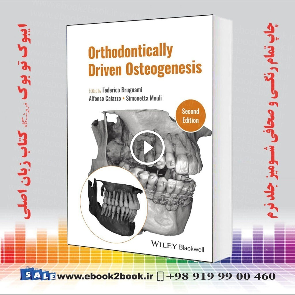 Orthodontically Driven Osteogenesis 2nd Edition