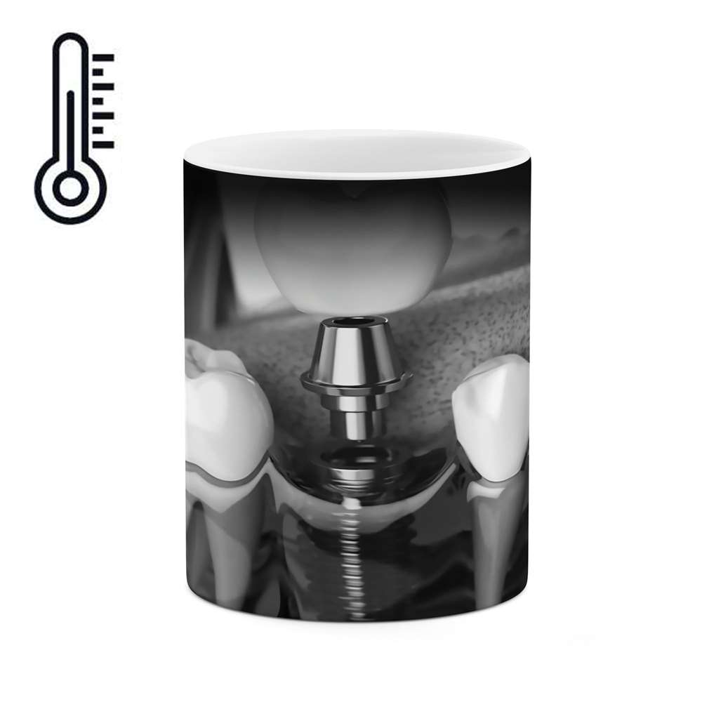 ماگ حرارتی طرح رشته پزشکی و پرستاری  مدل mgph10663