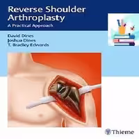 Reverse Shoulder Arthroplasty A Practical Approach 1ed PDF Video at €2 - کتاب پزشکی بهار