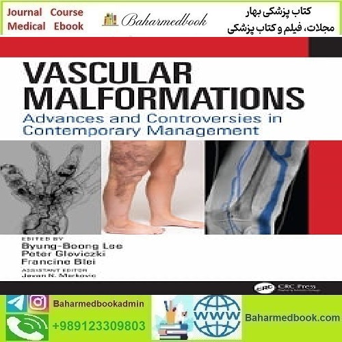 Vascular Malformations Advances and