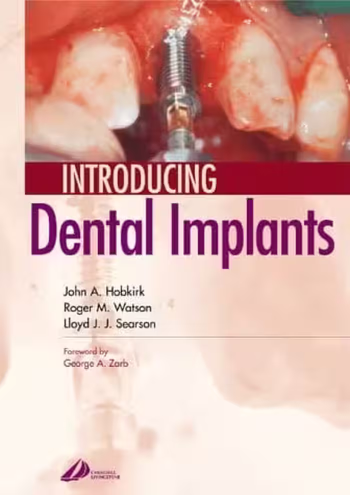 󾕇 دانلود کتاب Introducing Dental Implants, 2003 - دانلود کتاب های دانشگاهی