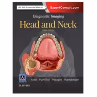 کتاب Diagnostic Imaging:Head and Neck اثر KOCH HAMILTON انتشارات الزویر