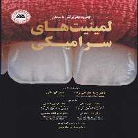 گام به گام تراش تا سمان لمینت های سرامیکی