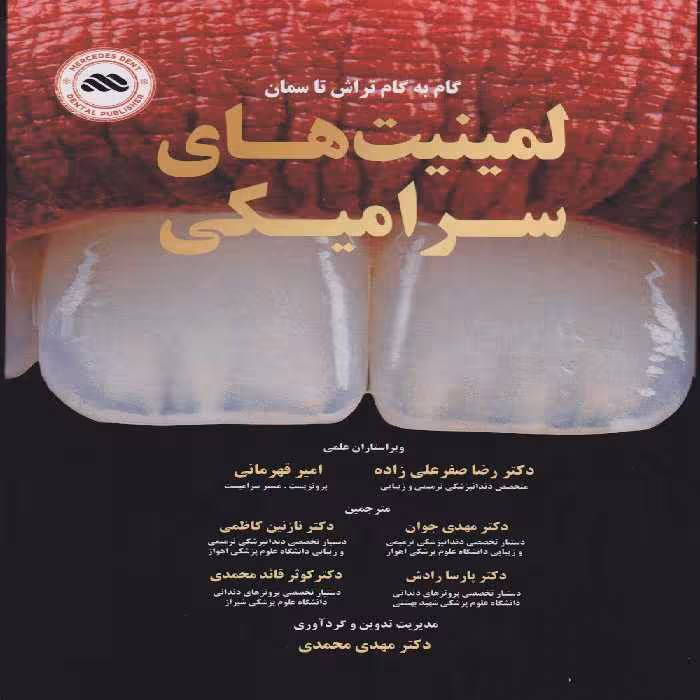 گام به گام تراش تا سمان لمینت های سرامیکی