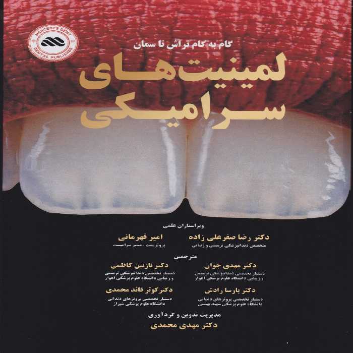 گام به گام تراش تا سمان لمینت های سرامیکی