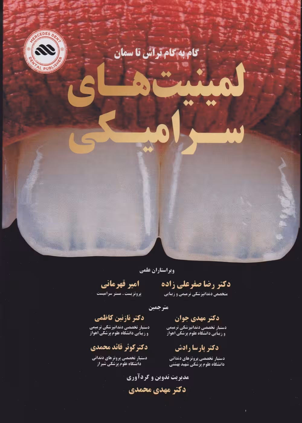 گام به گام تراش تا سمان لمینت های سرامیکی