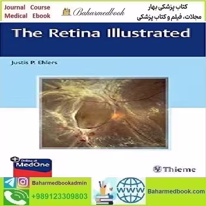 The Retina Illustrated 2020 TRUE PDF price 1€ - کتاب پزشکی بهار
