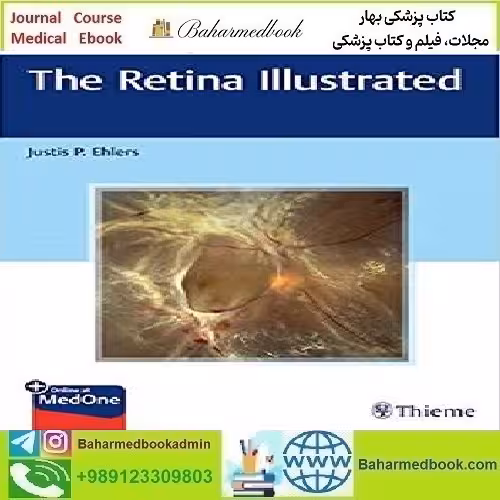 The Retina Illustrated 2020 TRUE PDF price 1€ - کتاب پزشکی بهار
