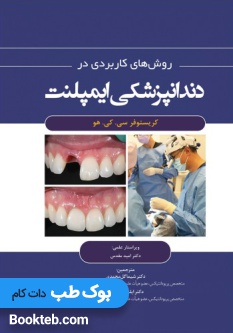 روش های کاربردی در دندانپزشکی ایمپلنت 2021
