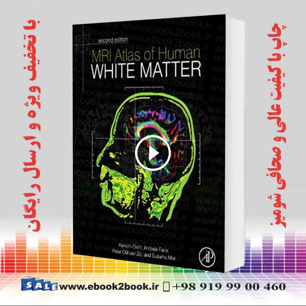 MRI Atlas of Human White Matter 2nd Edition