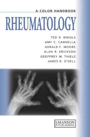 [PDF] دانلود کتاب Rheumatology - A Color Handbook, 2013