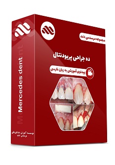ویدئوی ده جراحی پریودنتال