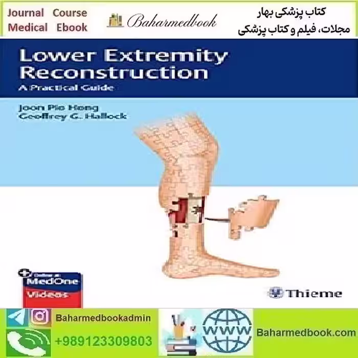 Lower Extremity Reconstruction A Practical Guide Video