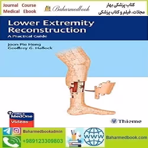 Lower Extremity Reconstruction A Practical Guide Video