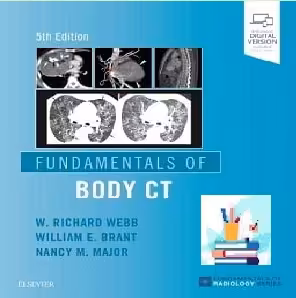 Fundamentals of Body CT TRUE PDF price 1€