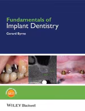 󾕇 دانلود کتاب Fundamentals Of Implant Dentistry, 2014 - دانلود کتاب های دانشگاهی