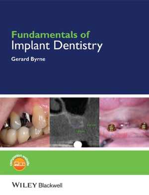  دانلود کتاب Fundamentals Of Implant Dentistry, 2014 - دانلود کتاب های دانشگاهی
