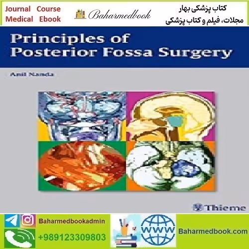 Principles of Posterior Fossa Surgery Surgical Management 2012