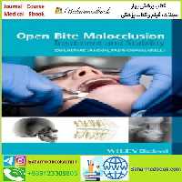 Open Bite Malocclusion TRUE PDF price 1€ - کتاب پزشکی بهار