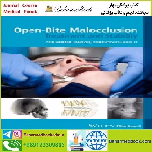 Open Bite Malocclusion TRUE PDF price 1€ - کتاب پزشکی بهار