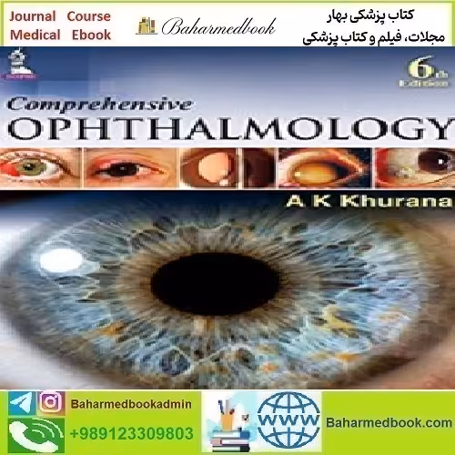 Comprehensive Ophthalmology 2015 TRUE PDF price 1€ - کتاب پزشکی بهار
